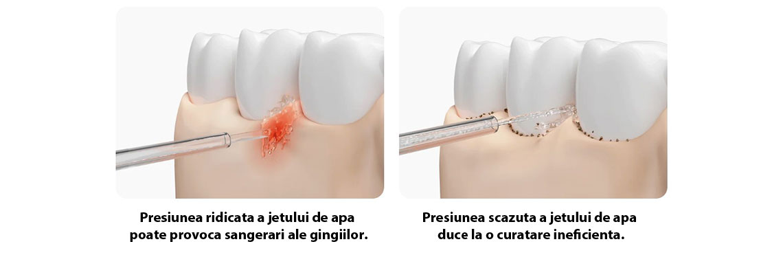Irigator bucal Xiaomi Water Flosser 2